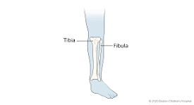 Image result for icd 9 code for tib fib fracture