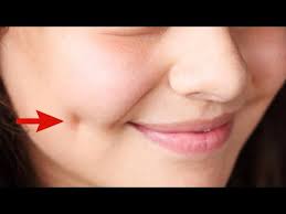 how to get dimples fast and naturally