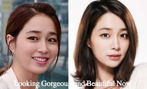 lee min jung plastic surgery before and