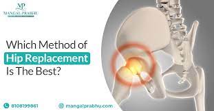 which method of hip replacement is the