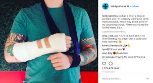 I don't use this anymore, please follow me on teddysphotos on instagram, lots of love x. Ed Sheeran S Asian Tour Dates In Doubt Following Cycling Accident