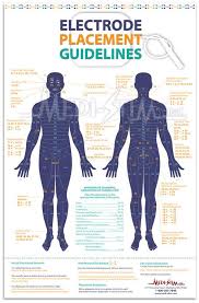 Electrode Placement Guidelines Tens Electrode Chart Medi