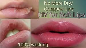 homemade lip balm for chapped lips