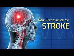 treatment of stroke health matters