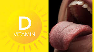 vitamin d deficiency signs and
