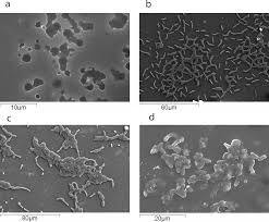Listeria monocytogenes is the species of pathogenic bacteria that causes the infection listeriosis. Plos One Biofilm Forming Abilities Of Listeria Monocytogenes Serotypes Isolated From Different Sources