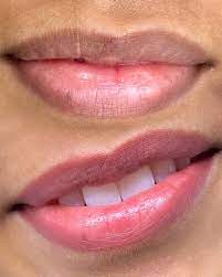lips neutralization dark lips color