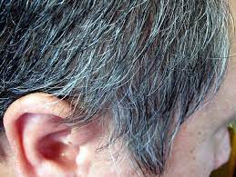 what causes pre graying in hair