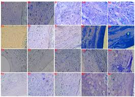 staining of undecalcified bone sles