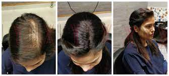 Your hair stylist will be able to give you a definitive answer. Hair Wigs Extension Hair Patch Eyelash Gurgaon Hair Weaving In Ardee City Gurgaon