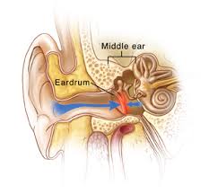 Ear Barotrauma