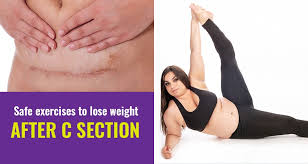 lose weight after c section delivery