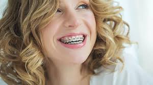 Mar 30, 2020 · does dental insurance cover dentures? How Much Are Braces With Insurance
