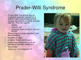 Williams racing, wantage, united kingdom. Prader Willi Syndrome Isabella S Story Home Facebook