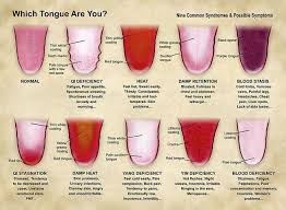 Traditional Chinese Medicine Tongue Diagnosis Charts Album