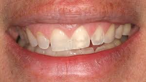 canted smile and what cosmetic dentists