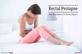 rectal prolapse types causes