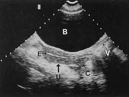 Pelvic ultrasound is usually the initial modality for imaging gynecologic pathology, including acute pelvic pain and chronic pelvic pain. Diagnostic Ultrasonography In Gynecology Glowm