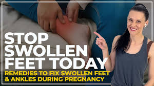 swollen feet pregnancy fix stop