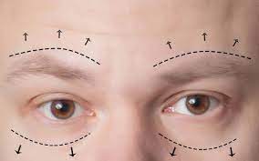 the types of eyelid surgery advanced