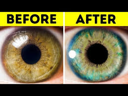 7 things that can change your eye color