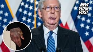 Find and save turtle face memes | from instagram, facebook, tumblr, twitter & more. Mitch Mcconnell S Weird Purple Hands May Have An Easy Explanation