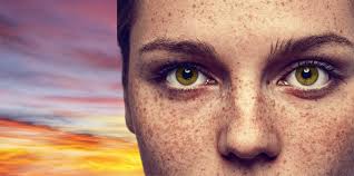 spiritual meaning of freckles freckle