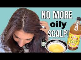 get rid of oily scalp naturally diy