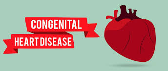 Image result for Congenital Heart Disease