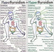 Hypothyroidism Vs Hyperthyroidism Nursing Hypothyroidism