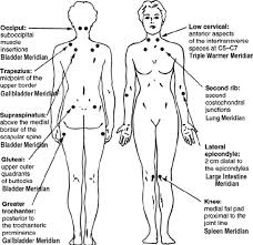 American College Of Rheumatology Acr Fibromyalgia Tender