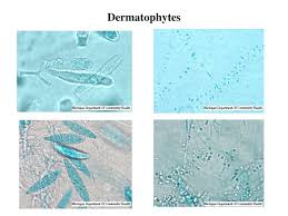 Mycology Survey Id Of Normal Dermatophytes