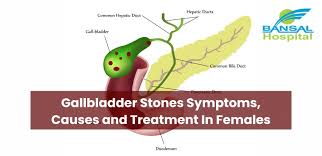 gallbladder stones symptoms causes and
