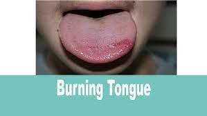 burning tongue syndrome causes