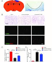 Fty720 Attenuates Neuronal Apoptosis Following Ischemic