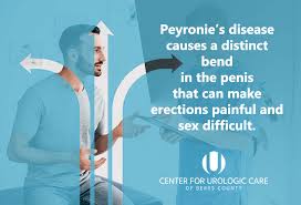 peyronie s disease center for