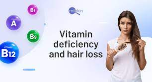 vitamin deficiency that cause hair loss
