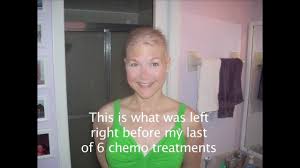 hair regrowth after chemo