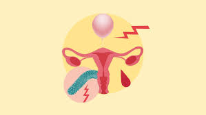 7 symptoms of uterine cancer you