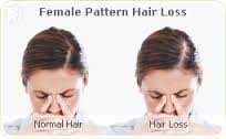 is hair loss a symptom of menopause