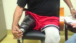 lower limb prosthetic sockets and