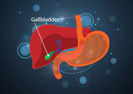 gallbladder removal go light bariatrics