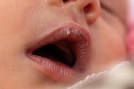 premium photo newborn baby with dry lips