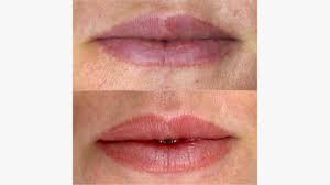 lip blushing tattoo procedure benefits