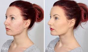 make up skin with acne s for a