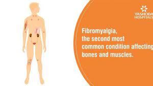 fibromyalgia the second most common