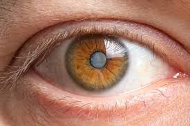 what to expect with cataract surgery