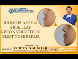 abbe flap reconstruction cleft nose repair
