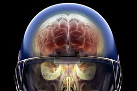 The link between football and traumatic brain injury continues to strengthen. Super Bowl 2020 Football Concussions The Link Between Head Injuries And Cte Explained Vox