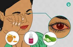home remes for eye allergy